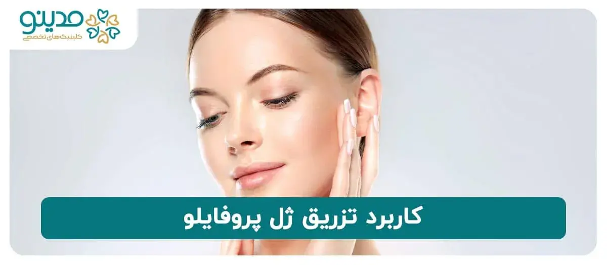 کاربرد تزریق ژل پروفایلو