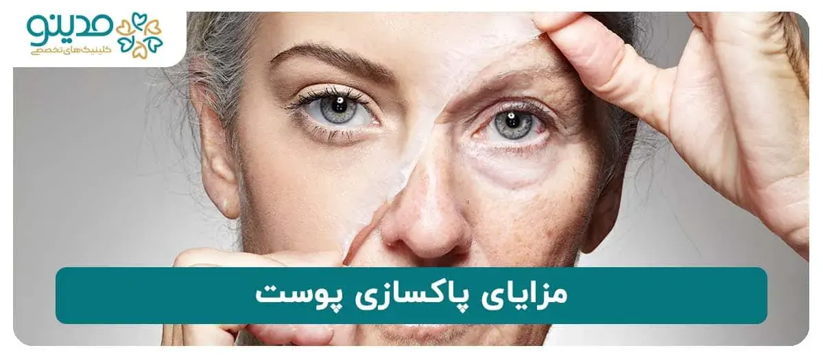 مزایای پاکسازی پوست 