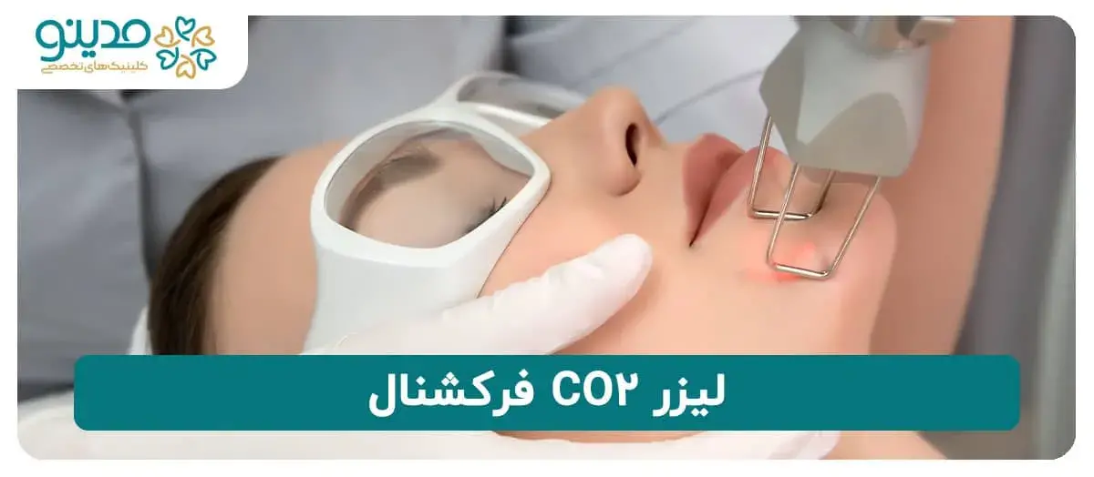 لیزر CO2 فرکشنال