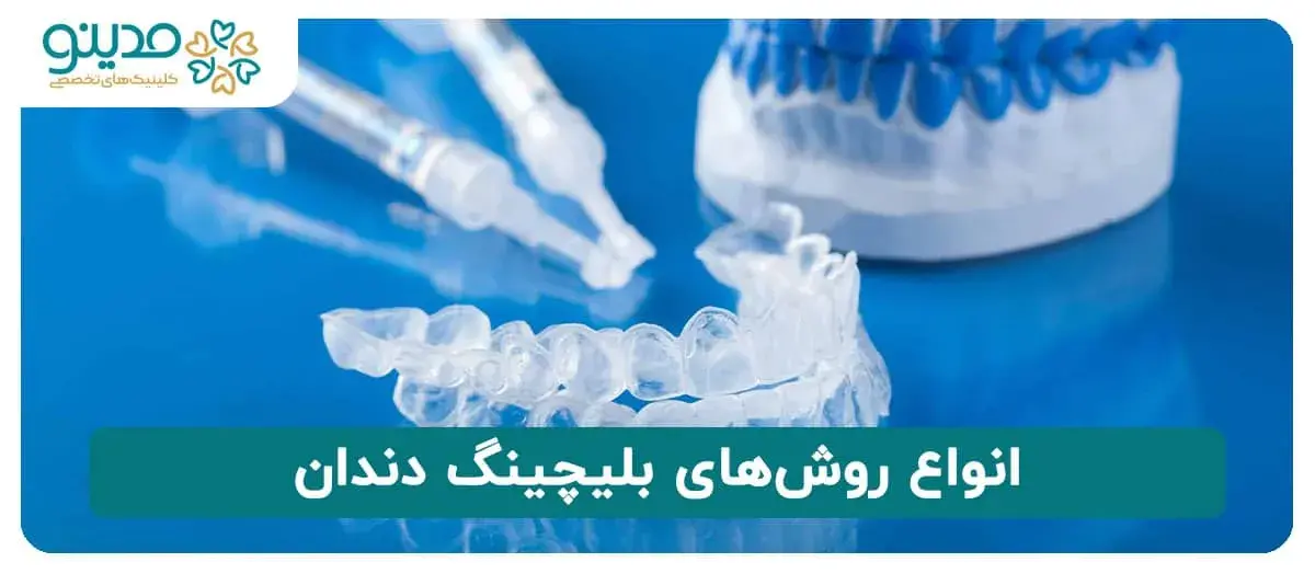 انواع روش‌های بلیچینگ دندان
