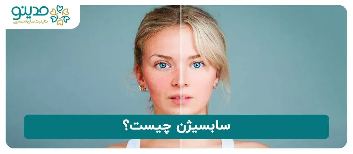 آشنایی با سابسیژن