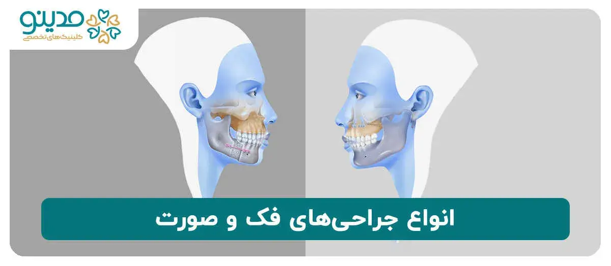 انواع جراحی‌های فک و صورت