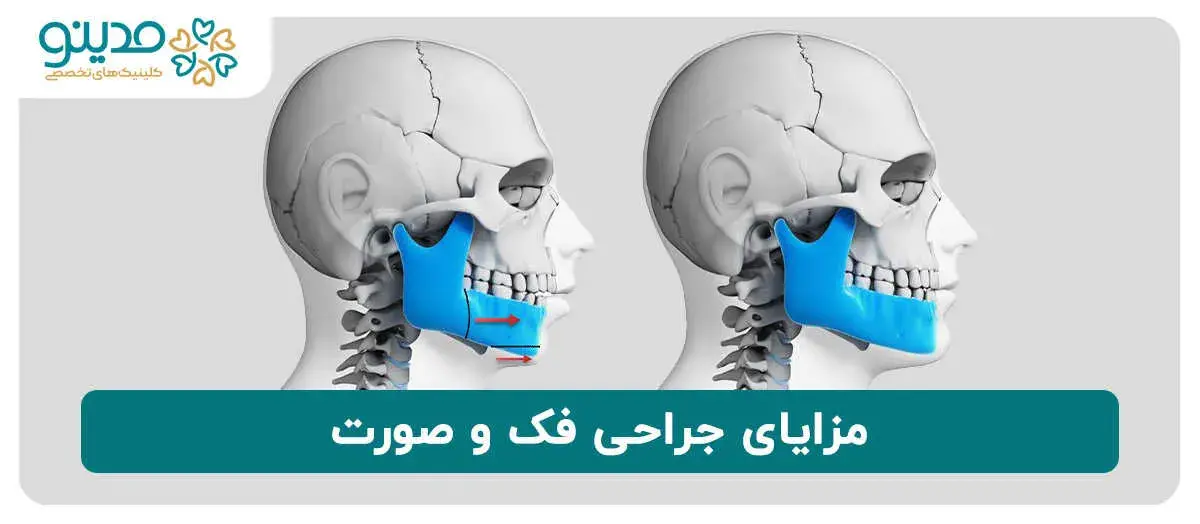 مزایای جراحی فک و صورت 