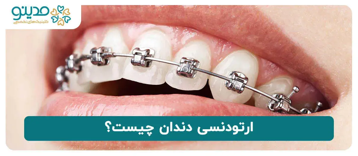 آشنایی با ارتودنسی دندان 