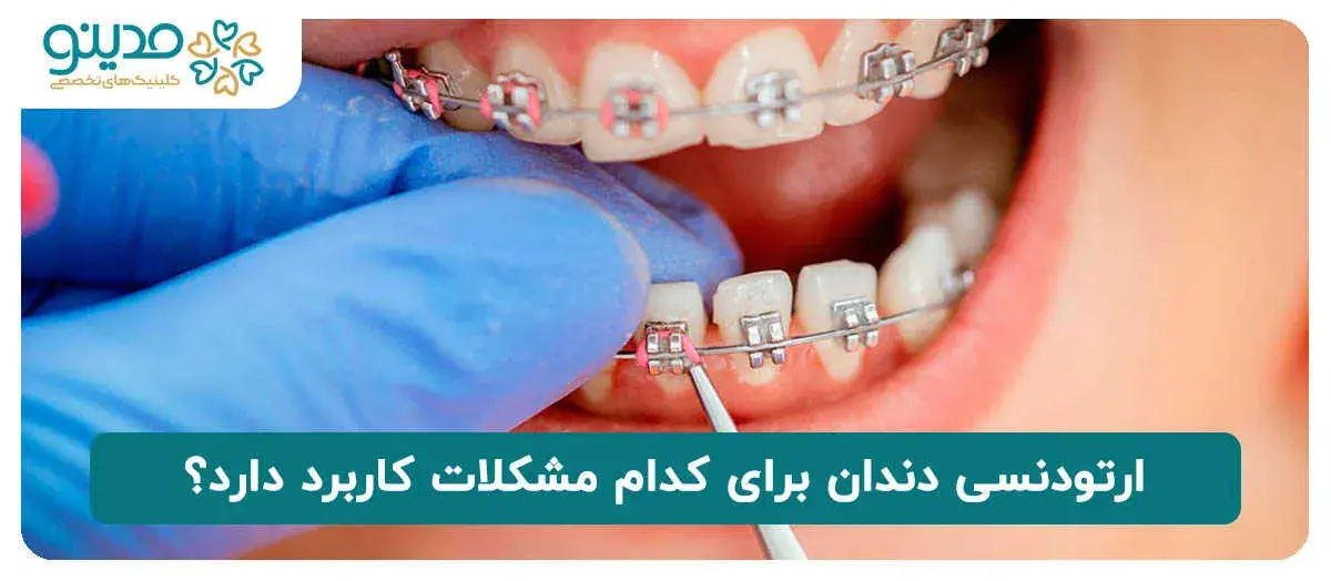 ارتودنسی دندان برای کدام مشکلات کاربرد دارد؟
