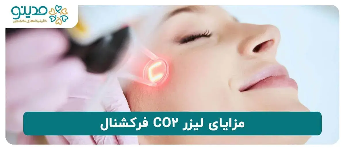 مزایای لیزر CO2 فرکشنال 