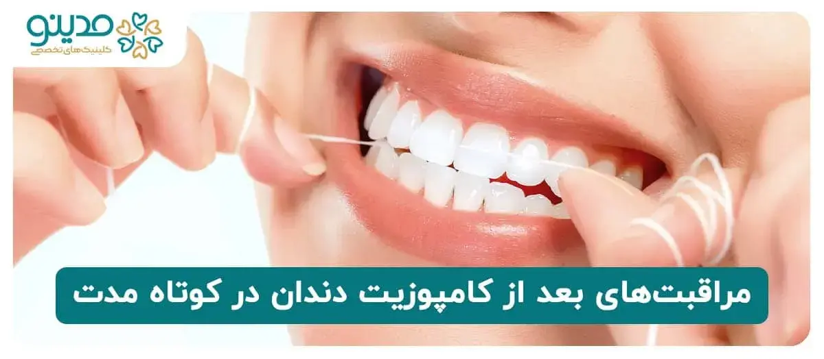 مراقبت‌های بعد از کامپوزیت دندان در کوتاه مدت