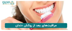 مراقبت‌های بعد از روکش دندان