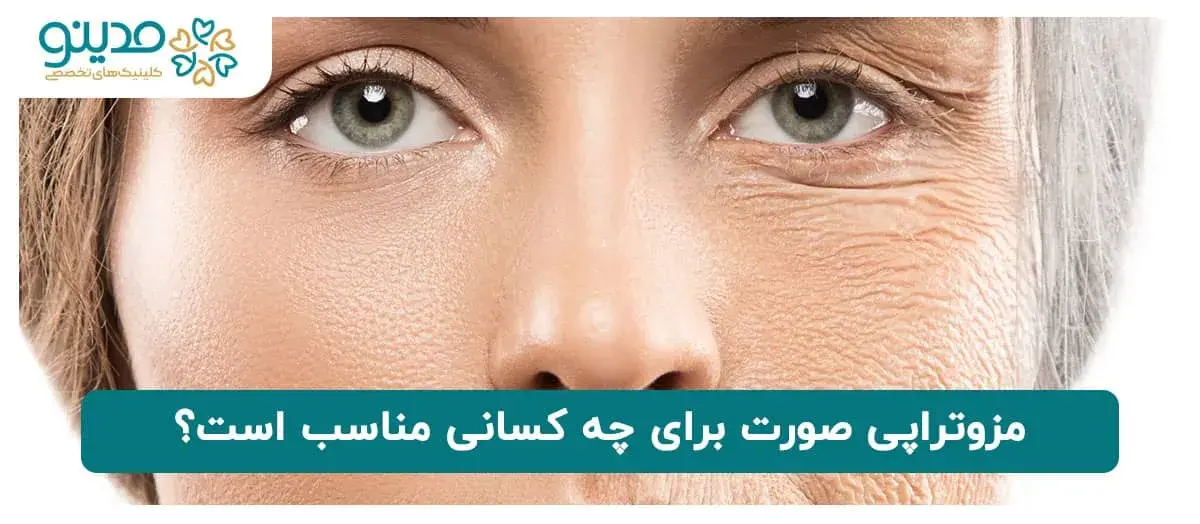 مزوتراپی صورت برای چه کسانی مناسب است؟