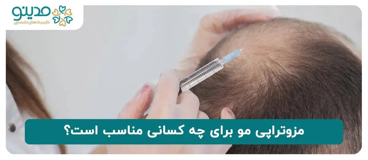 مزوتراپی مو برای چه کسانی مناسب است؟