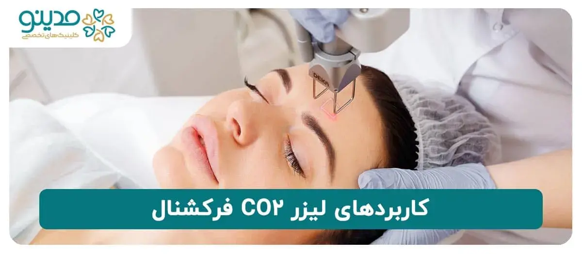 کاربردهای لیزر CO2 فرکشنال