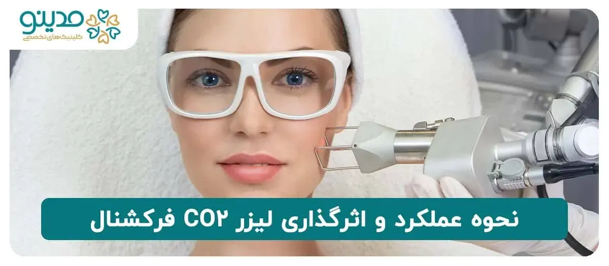 نحوه عملکرد و اثرگذاری لیزر CO2 فرکشنال