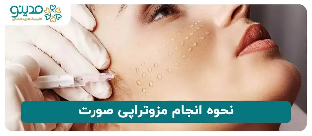 نحوه انجام مزوتراپی صورت