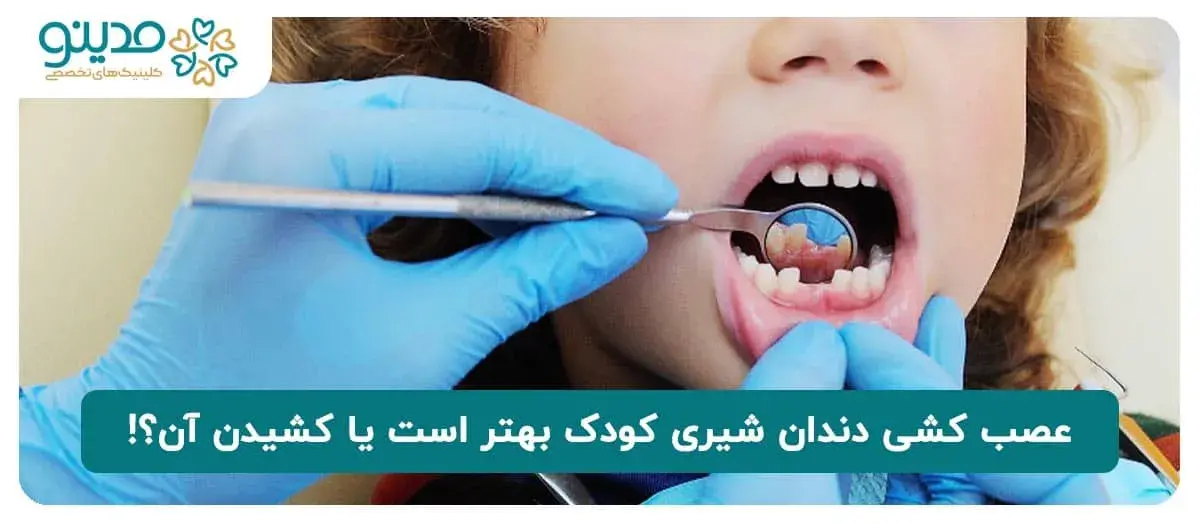 عصب کشی دندان شیری کودک بهتر است یا کشیدن آن؟!