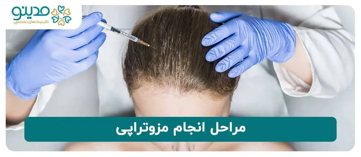 مراحل انجام مزوتراپی