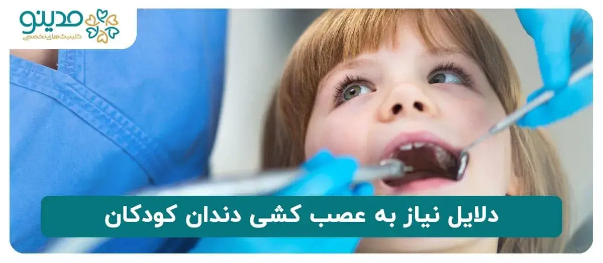 دلایل نیاز به عصب کشی دندان کودکان