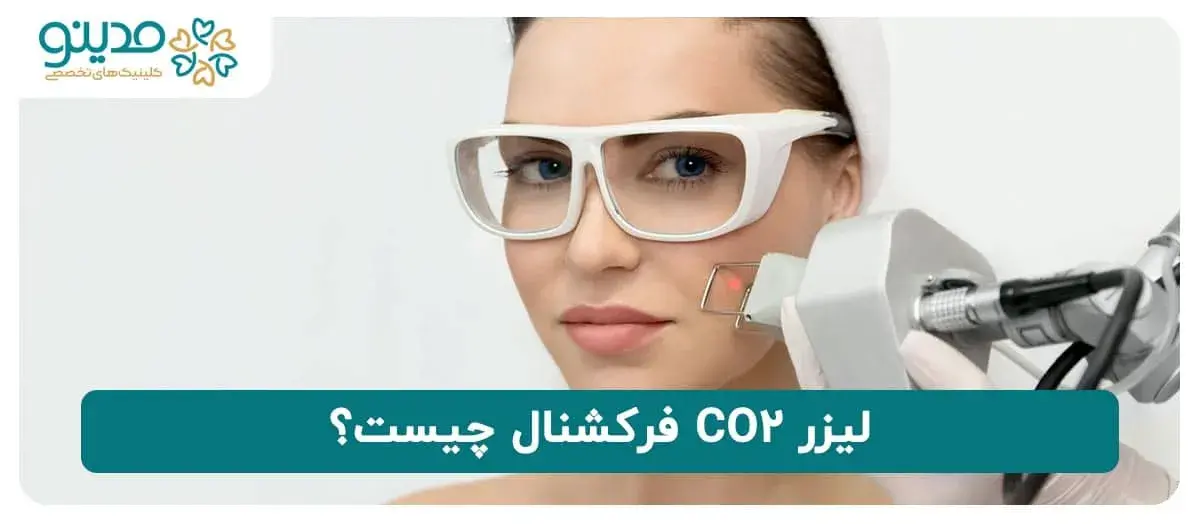 آشنایی با لیزر CO2 فرکشنال 