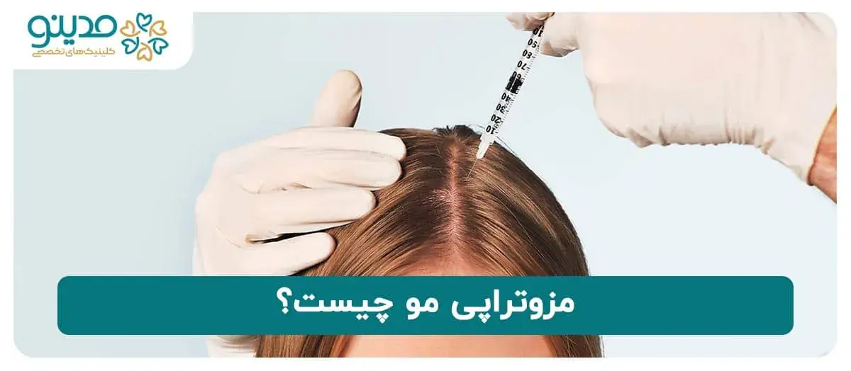 مزوتراپی مو چیست؟