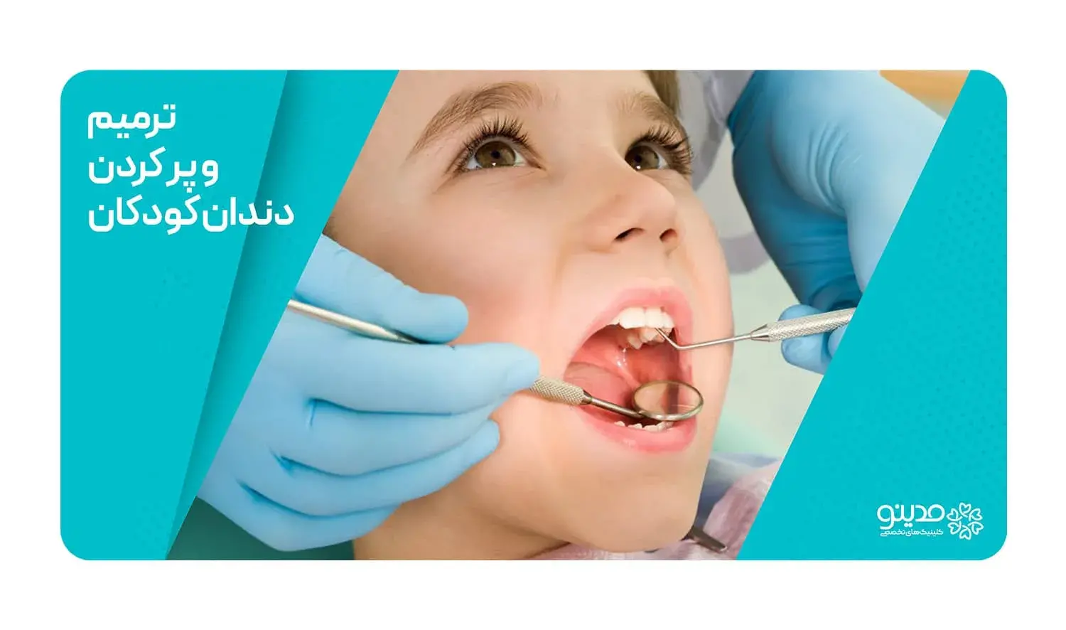 childrens-dental-restorations