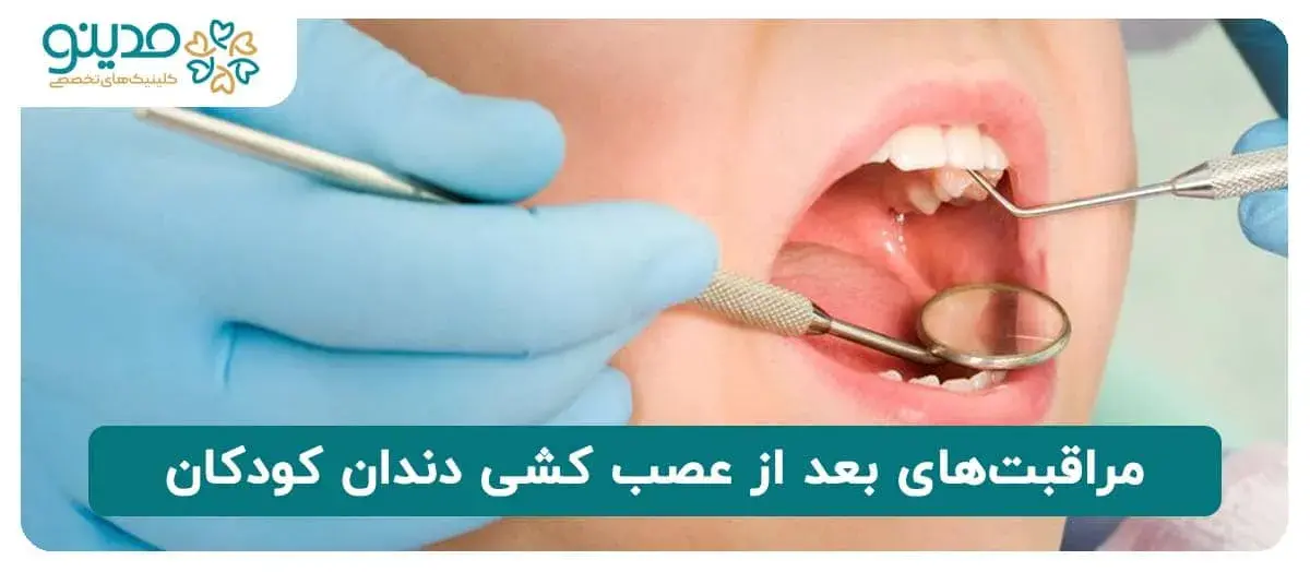 مراقبت‌های بعد از عصب کشی دندان کودکان