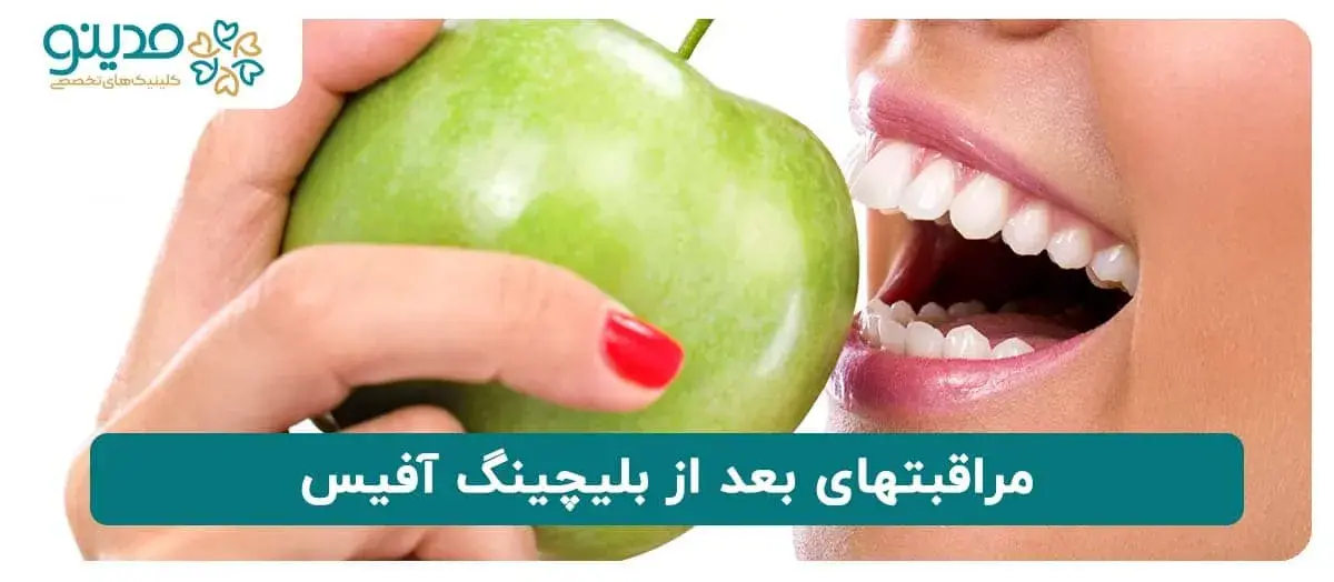 مراقبتهای بعد از بلیچینگ آفیس