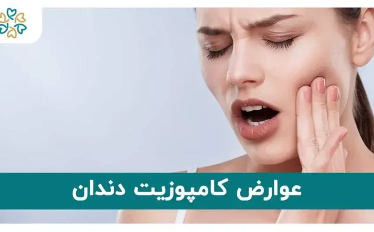  مضرات کامپوزیت دندان؛ آیا کامپوزیت به دندان آسیب میزند؟