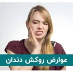 عوارض روکش دندان