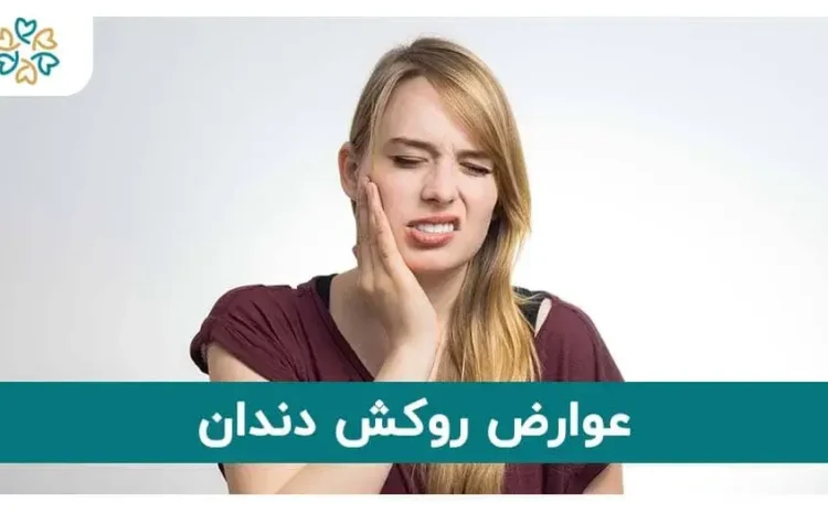  عوارض و مشکلات روکش دندان؛ در صورت قورت دادن روکش چه کنیم؟