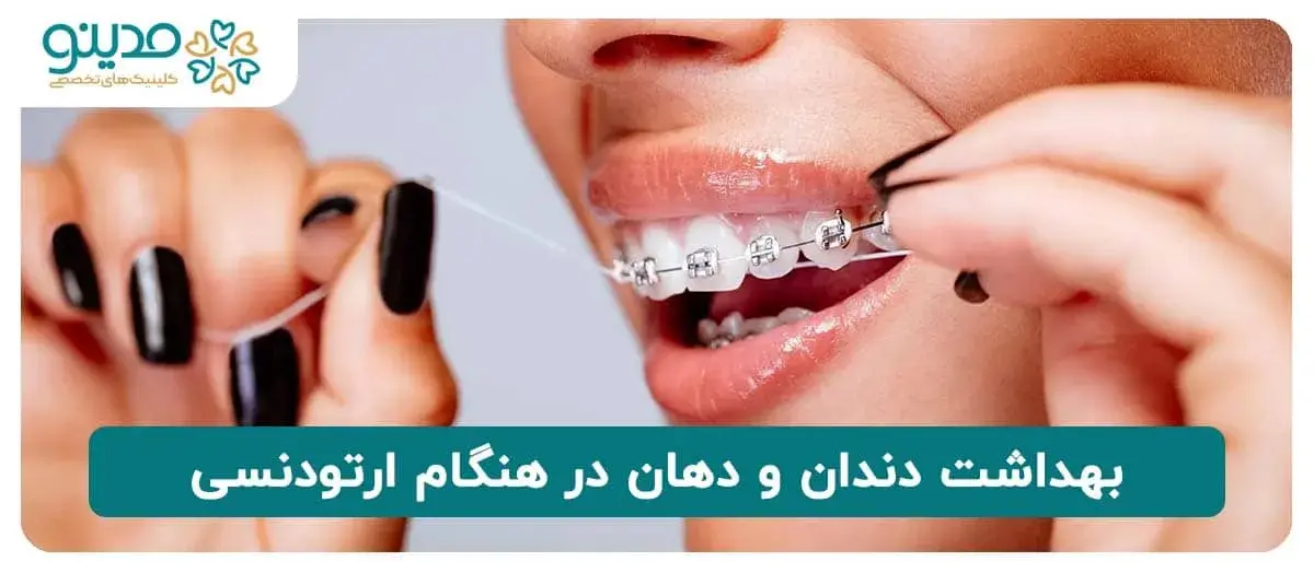 بهداشت دندان و دهان در هنگام ارتودنسی