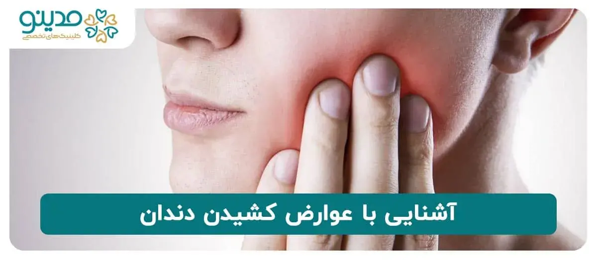 با عوارض کشیدن دندان آشنا شوید!