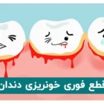 قطع فوری خونریزی دندان