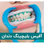 آفیس بلیچینگ دندان