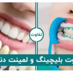 تفاوت بلیچینگ و لمینت دندان