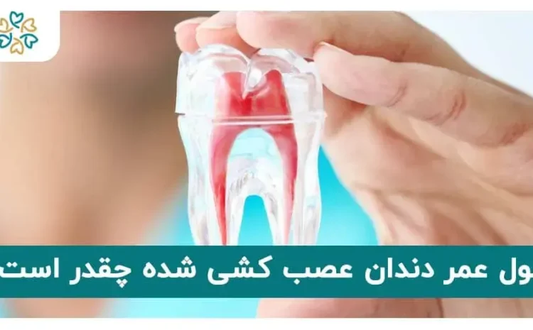  دندان عصب کشی شده چقدر عمر میکند؟ آیا مجدد خراب میشود؟