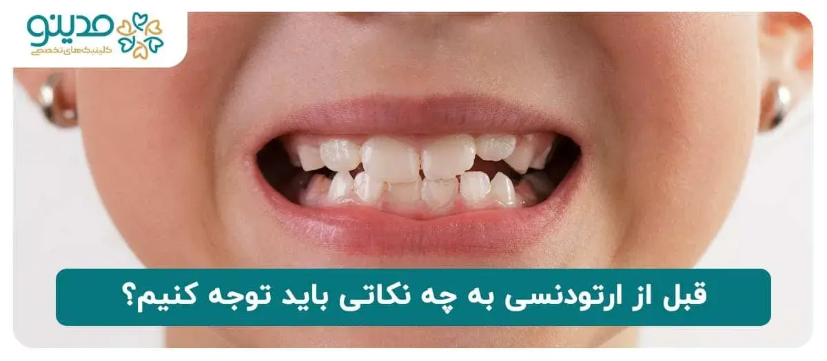 قبل از ارتودنسی به چه نکاتی باید توجه کنیم؟