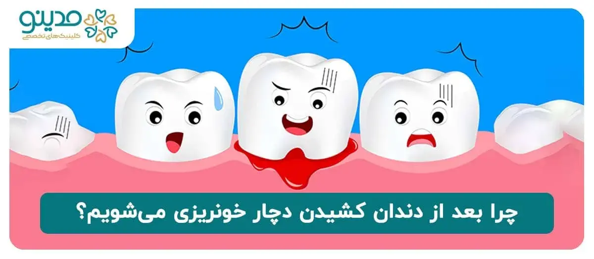چرا بعد از دندان کشیدن دچار خونریزی می‌شویم؟