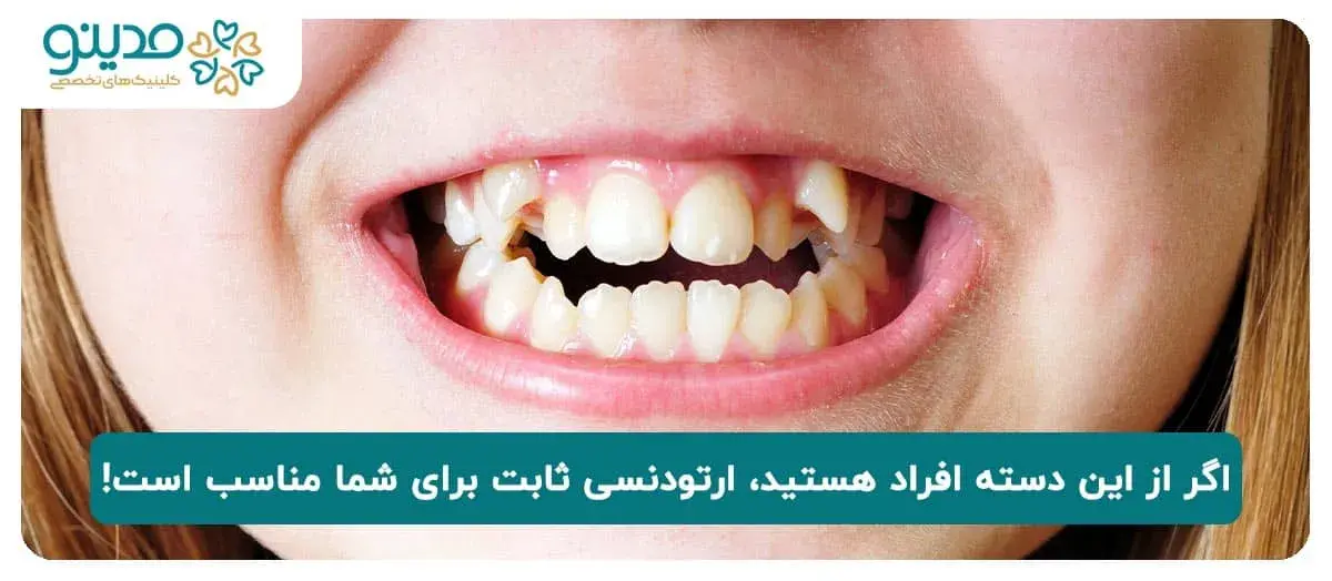 اگر از این دسته افراد هستید، ارتودنسی ثابت برای شما مناسب است!