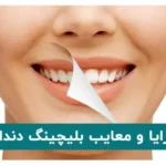 مزایا و معایب بلیچینگ دندان
