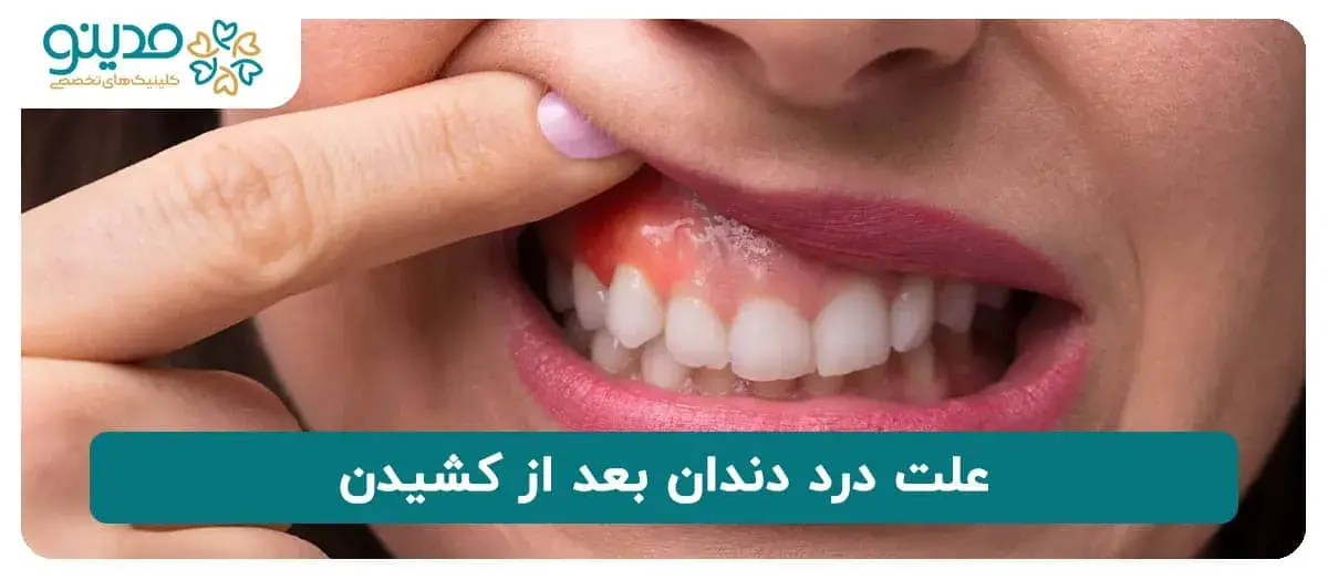 علت درد دندان بعد از کشیدن