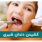 کشیدن دندان شیری