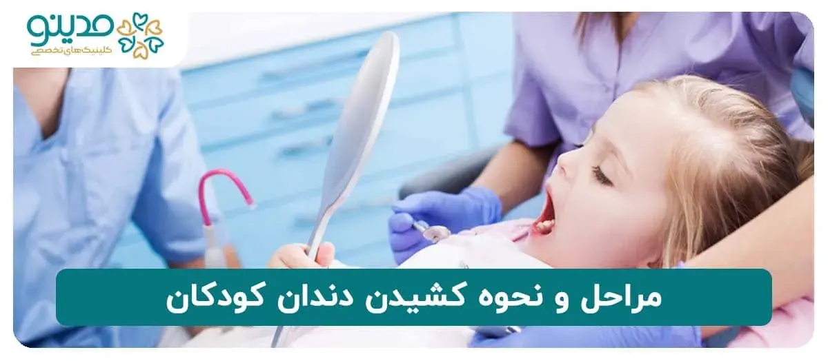 مراحل و نحوه کشیدن دندان کودکان