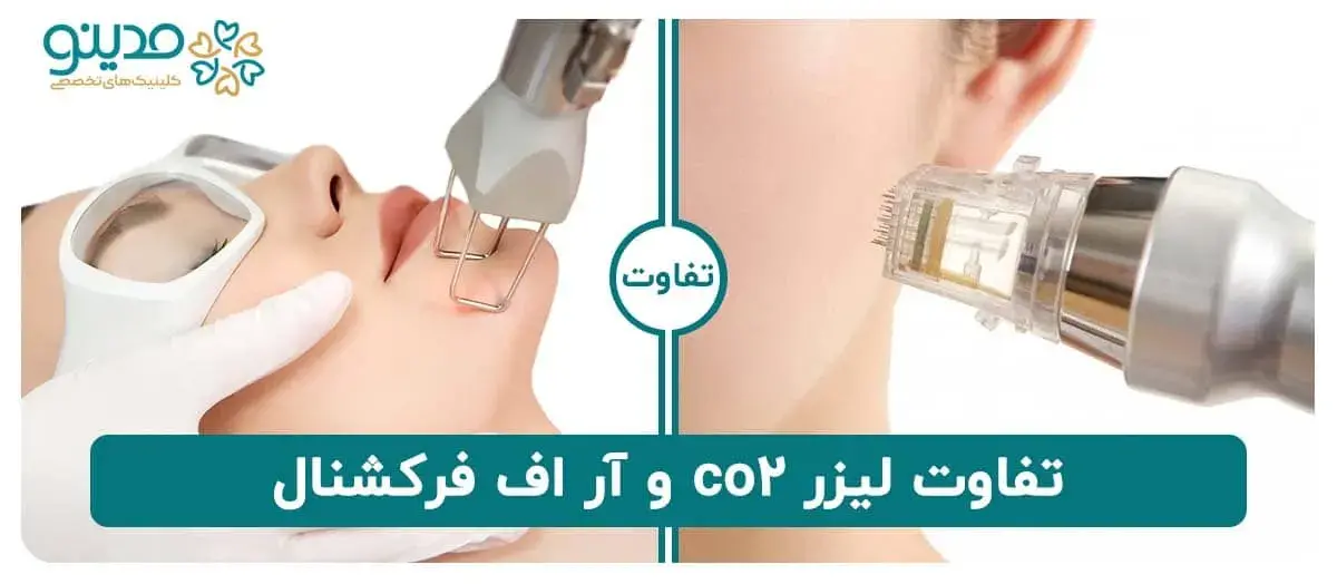 تفاوت لیزر co2 و آر اف فرکشنال