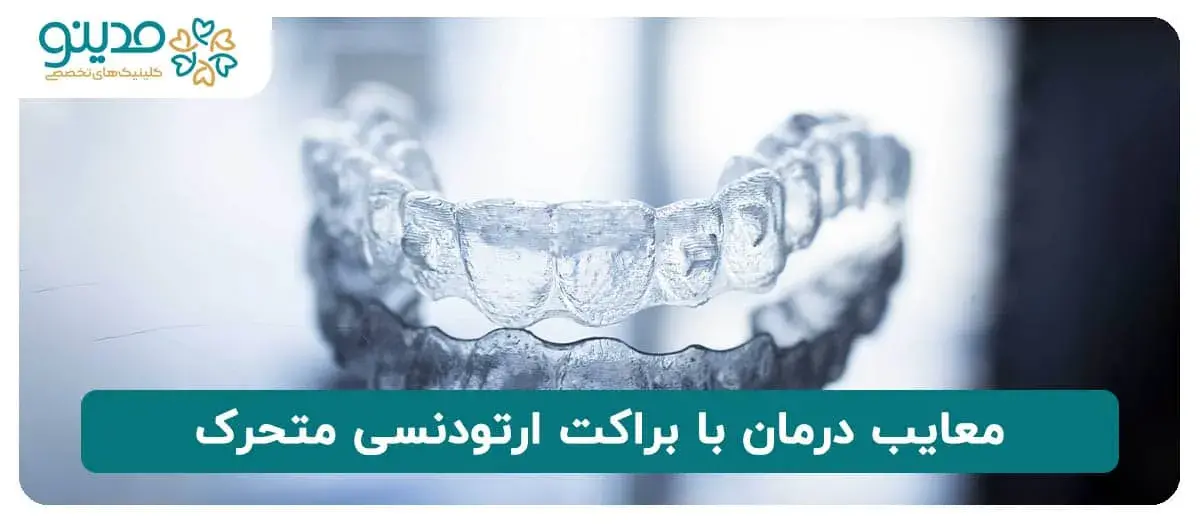 معایب درمان با براکت ارتودنسی متحرک