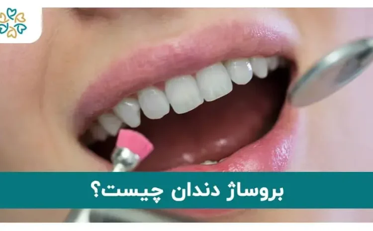 بروساژ دندان چیست؟
