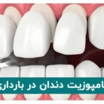 کامپوزیت دندان در بارداری