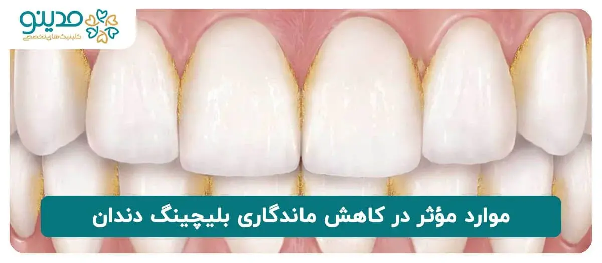 موارد مؤثر در کاهش ماندگاری بلیچینگ دندان