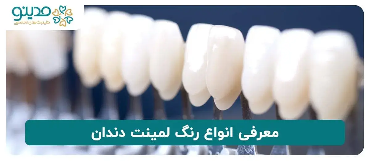 معرفی انواع رنگ لمینت دندان