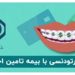 هزینه ارتودنسی با بیمه تامین اجتماعی