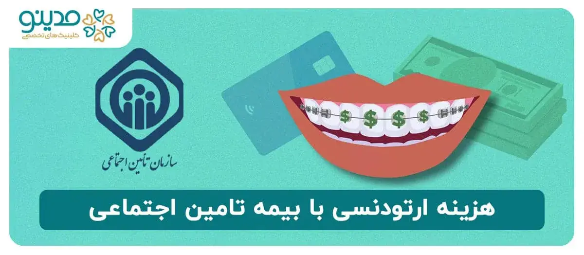 هزینه ارتودنسی با بیمه تامین اجتماعی