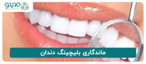 ماندگاری بلیچینگ دندان
